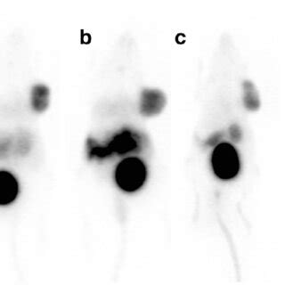 Pet Maximum Intensity Projection Images Of A Ga Dotatoc B