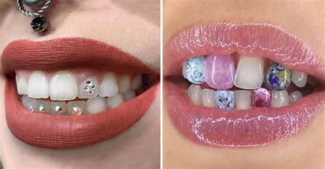 Tooth Gems Is The New Hot Beauty Trend And I Dont Hate Them