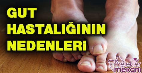 Gut Hastal Nedir Gut Hastal N N Belirtileri Ve Nedenleri