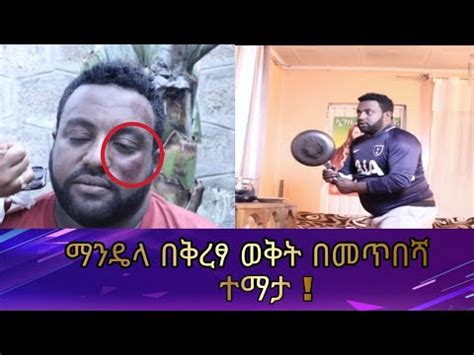 ካሳሁን ፍስሀ ማንዴላ በቀረፃ ወቅት ያጋጠመውን ጉድ ተመልከቱ kasahun fisha ethiopian