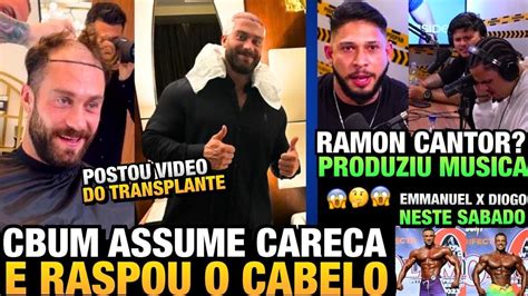 SONHO DO RAMON CBUM APARECE CARECA E FEZ UM TRANSPLANTE DIOGO VS