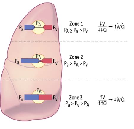 Ventilation Perfusion Ratios and V/Q mismatch Flashcards | Quizlet