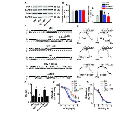 Inhibition Of Cox 2 By Celecoxib Attenuates Hcy Induced Increase In Download Scientific