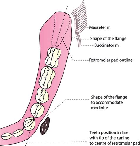 Retromolar Pad Anatomy