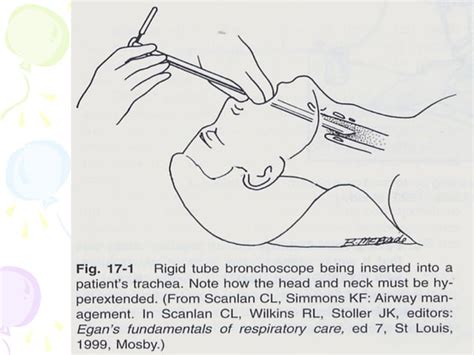 Bronchoscopy Diagnostic Technique Ppt