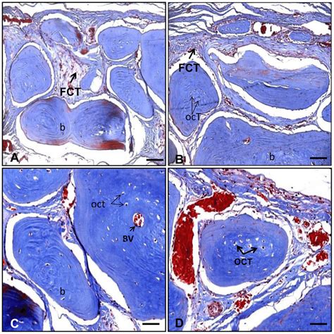 Histological Sections Of The Rat Calvaria Critical Size Defect Treated