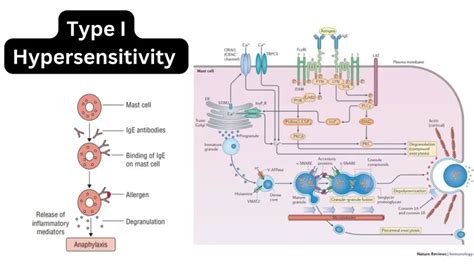 Type 1 Anaphylactic Hypersensitivity Reaction Definition Mechanism