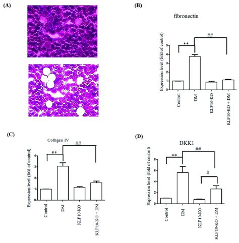 Repression Of Fibrosis Related Gene Expression In Klf10 Knockout