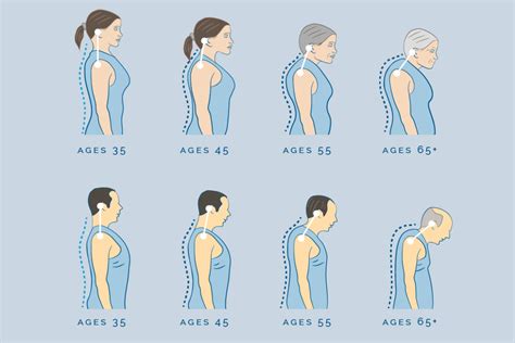 Spinal Curvature Aging Process Rehab Concepts