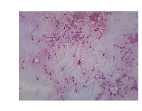 Human Sperm Smear – Prepared Microscope Slide – 75x25mm | KLM Bio ...