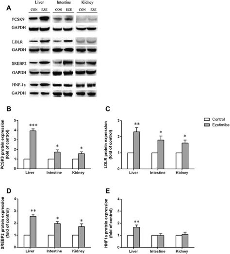 The Expression Of Pcsk Ldlr Srebp And Hnf Proteins In Liver