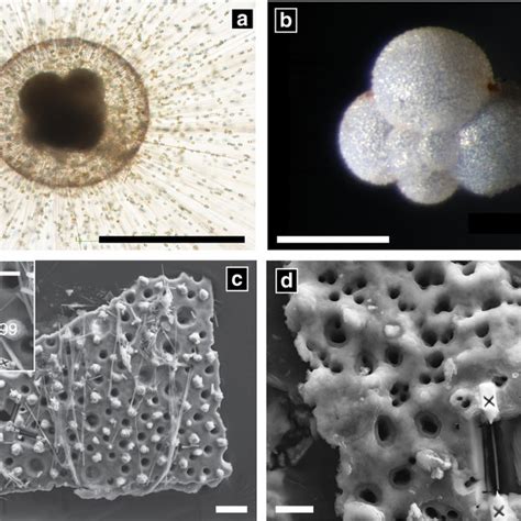 The Structure Of Foraminiferal Shells Aorbulina Universa Develops A