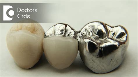 Comparison Between Ceramic Porcelain And Metal Crowns Dr Aniruddha