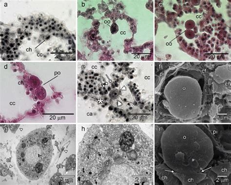 Early Stages Of The Oogenesis Of Paraleucilla Magna A E Light Download Scientific Diagram