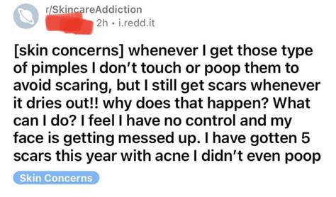 Only Pores Poop Hun Bun 💁🏽‍♀️💅🏽 Rscacirclejerk