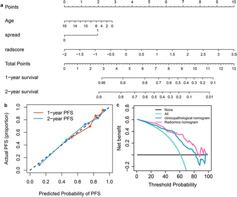 Radiomics Nomogram A The Nomogram Was Developed By Incorporating Download Scientific Diagram