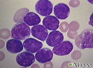 Blood smear Information | Mount Sinai - New York