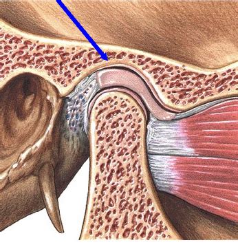 Temporomandibular Joint Flashcards Quizlet