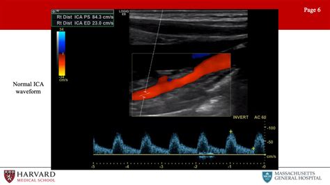 Vascular Surgery Exam Prep Vascular Lab