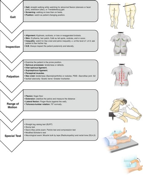 Fig 2 60 Summary Of Back Examination Skills In Rheumatology