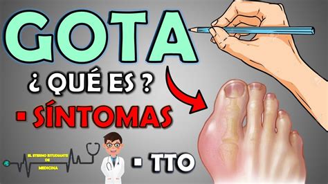 QUÉ ES LA GOTA Y CUÁLES SON LOS SÍNTOMAS TRATAMIENTO