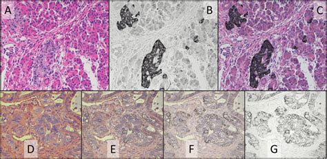 Simultaneous H E And Ihc Staining Of Normal Pancreas Ffpe Tissue For