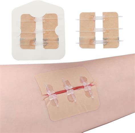 Longmed Waterproof Wound Closure Strips - Butterfly India | Ubuy