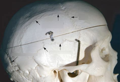 parietal bone Diagram | Quizlet