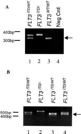 Pcr Detection Of The Flt Itd And Wt Flt In Adult De Novo Aml A Dna