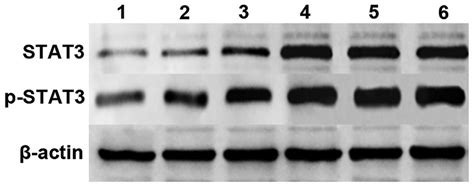 Analysis Of Western Blotting Results In Each Group Lane 1 E Group