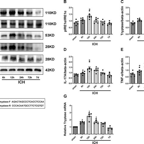 Representative immunofluorescence microphotographs of IRE1α and