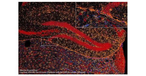 Resolve Biosciences Launches New Era In Single Cell Spatial Analysis