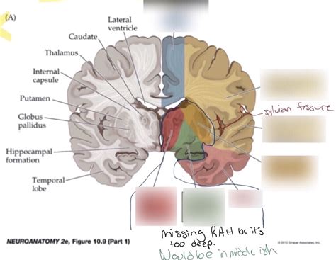 Summary Of Superficial And Deep Blood Supply To The Cerebral Hemisphere