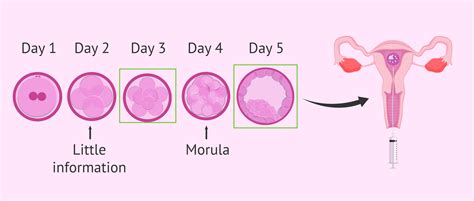 Day 3 Embryo Transfer Calendar Jacqui Lilllie