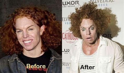 22 Celebrities That Have Not Aged Well Gallery Ebaums World