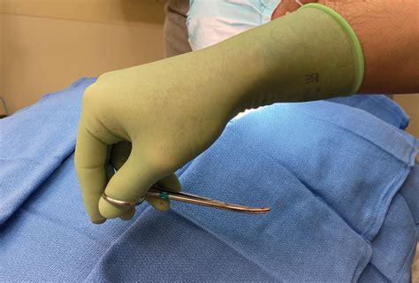 Reverse Grip Technique Of Scissors In Dermatologic Surgery Tips To