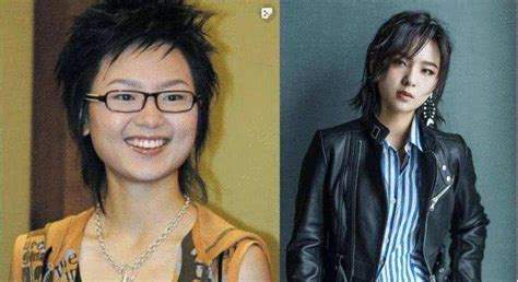 Zhou Bichang S Plastic Surgery Was Successful Generously Admit