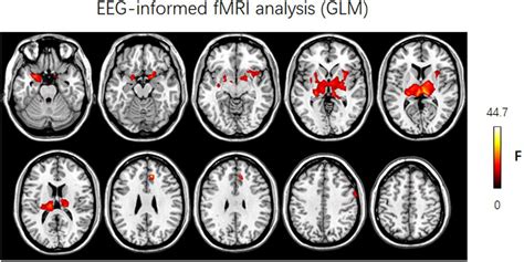 Frontiers Neuroscience Information Toolbox An Open Source Toolbox