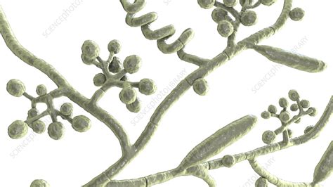 Athlete's foot fungus, illustration - Stock Image - F036/4107 - Science ...