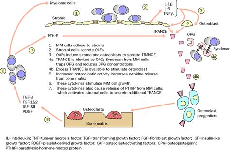 New Insights Into Role Of Microenvironment In Multiple Myeloma The Lancet