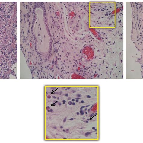 Immunohistochemical Detection Of Innate Immune Cells Using Hematoxylin