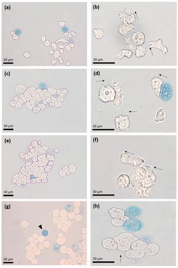 Microorganisms Special Issue Acanthamoeba Spp As Factors For Severe Infectious Diseases In