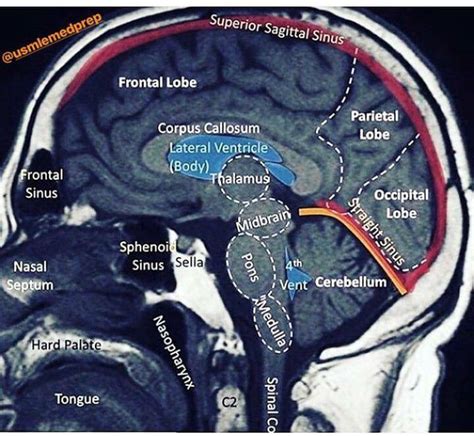 Brain Structure Medizzy