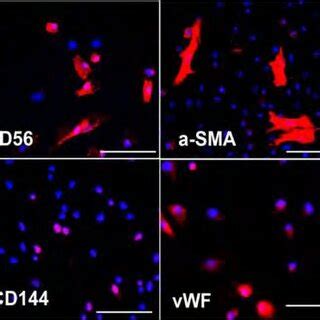 Differential Expressions Of Myogenic And Endothelial Markers By