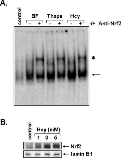 Endoplasmic Reticulum Stress Stimulates Are Binding Activity In