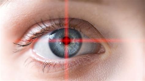 Effets Secondaires Du Lasik