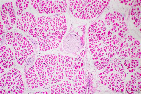 Skeletal Muscle Histology Labeled