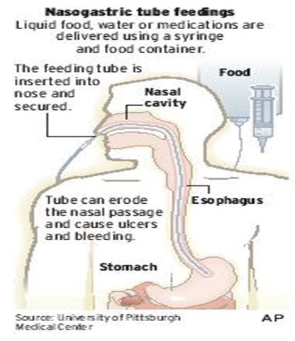 Enteral Nutrition Flashcards Quizlet