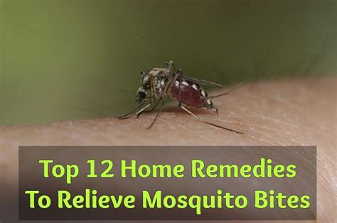 Top 12 Home Remedies To Relieve Mosquito Bites