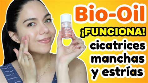 BIO OIL PARA ELIMINAR MANCHAS CICATRICES Y ESTRÍAS FUNCIONA